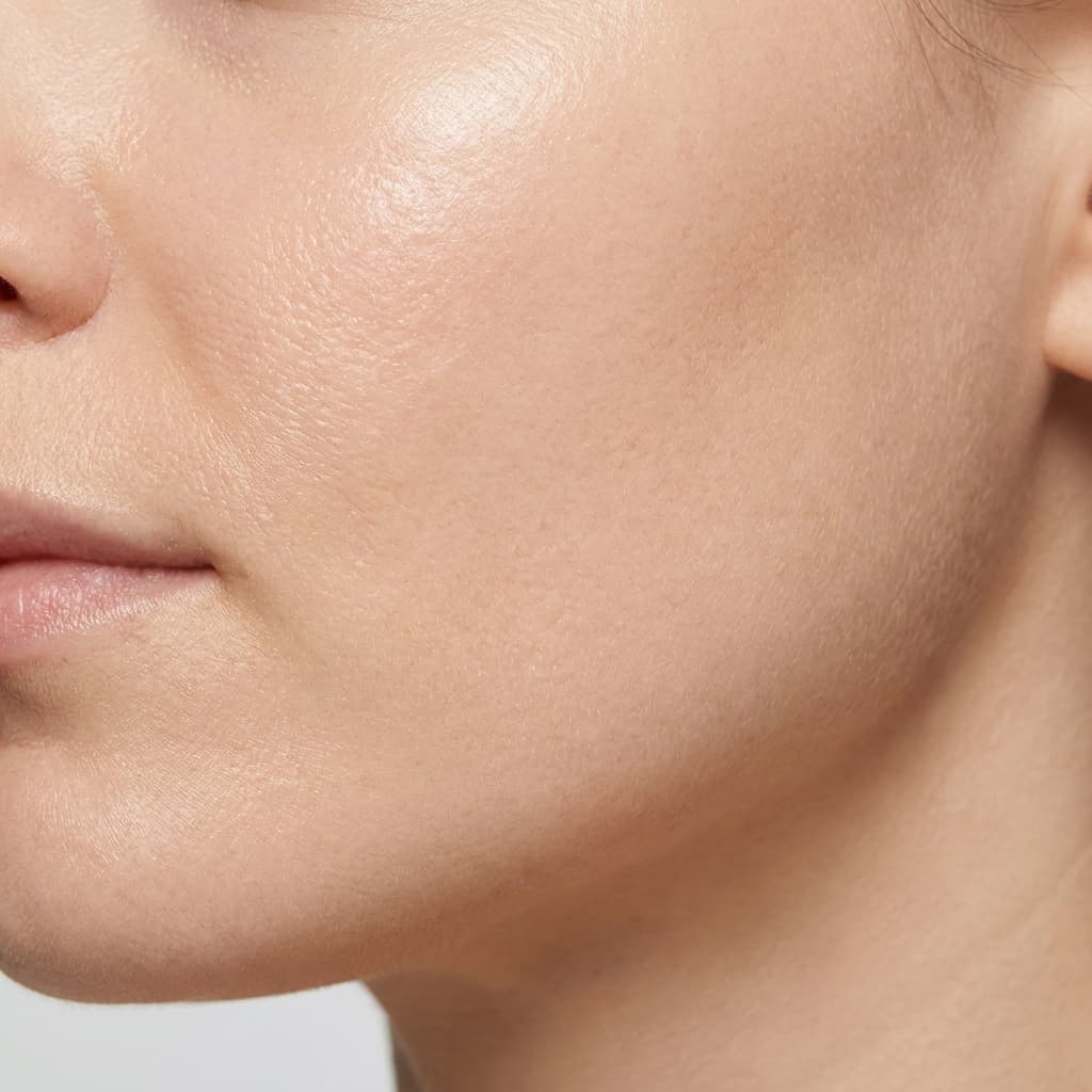 Skin after eight weeks